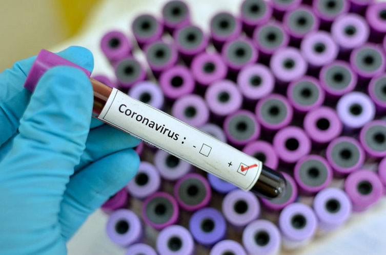 صورة فيروس كورونا :تسجيل أول حالة وفاة بالجزائر