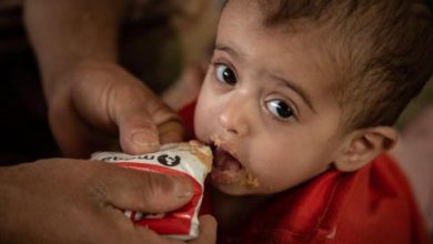 صورة نحو 8 ملايين طفل يواجهون خطر الموت بسبب سوء التغذية